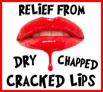 Colleyville dentist, Cassie Allison, DDS, tells you how to relieve your dry, chapped, and cracked lips!